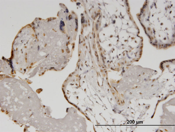 HELZ monoclonal antibody (M02), clone 5B2