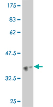 HELZ monoclonal antibody (M02), clone 5B2