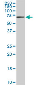 EPM2AIP1 monoclonal antibody (M01), clone 3H7