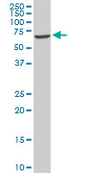 EPM2AIP1 monoclonal antibody (M01), clone 3H7