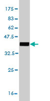 EPM2AIP1 monoclonal antibody (M01), clone 3H7
