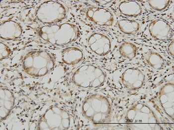 MTSS1 monoclonal antibody (M01), clone 2G9