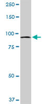 MTSS1 monoclonal antibody (M01), clone 2G9