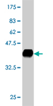 MTSS1 monoclonal antibody (M01), clone 2G9