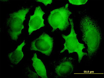 KIAA0101 monoclonal antibody (M01), clone 3C11-1F11