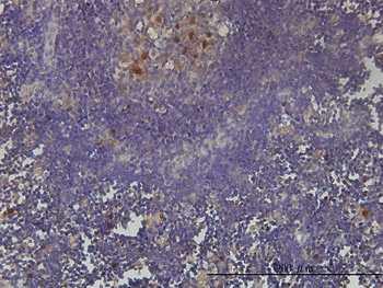 KIAA0101 monoclonal antibody (M01), clone 3C11-1F11
