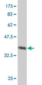 KIAA0101 monoclonal antibody (M01), clone 3C11-1F11