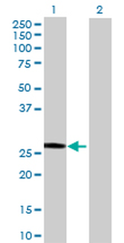 SART3 MaxPab mouse polyclonal antibody (B01)