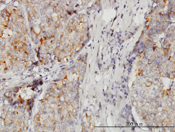 DOCK4 monoclonal antibody (M01), clone 3E7