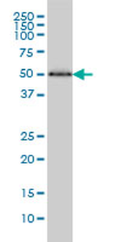 HERPUD1 monoclonal antibody (M04), clone 2G7
