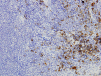HERPUD1 monoclonal antibody (M04), clone 2G7
