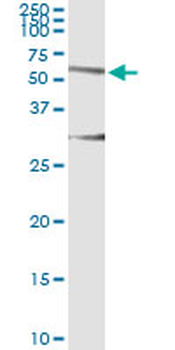 HERPUD1 monoclonal antibody (M04), clone 2G7