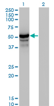 HERPUD1 monoclonal antibody (M04), clone 2G7