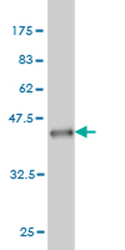 HERPUD1 monoclonal antibody (M04), clone 2G7