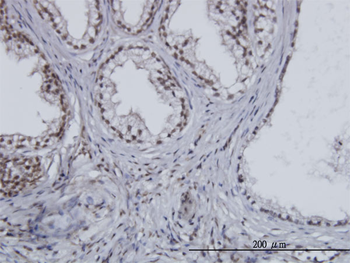 ESPL1 monoclonal antibody (M01), clone 6H6