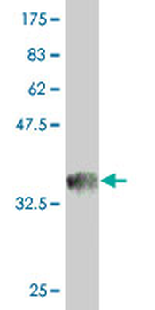 ESPL1 monoclonal antibody (M01), clone 6H6