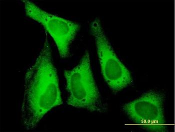 EIF5B purified MaxPab mouse polyclonal antibody (B01P)