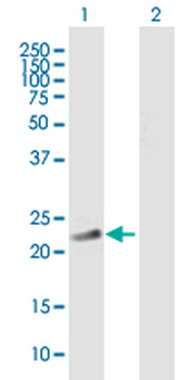 PDE4DIP MaxPab mouse polyclonal antibody (B01)