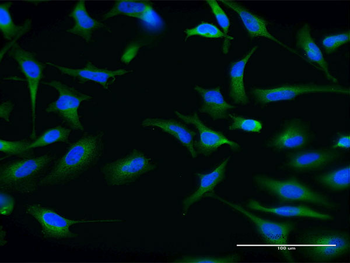 ABCG1 monoclonal antibody (M03), clone 2H8