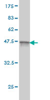 AKAP12 monoclonal antibody (M01), clone 1C5