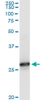 PRDX6 monoclonal antibody (M01), clone 3A10-2A11