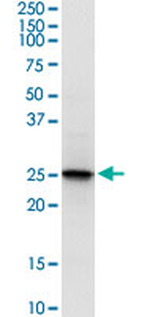 PRDX6 monoclonal antibody (M01), clone 3A10-2A11