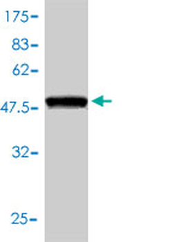 PRDX6 monoclonal antibody (M01), clone 3A10-2A11