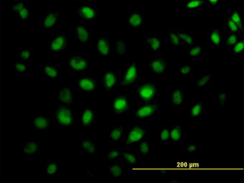 CREB5 monoclonal antibody (M02), clone 8A5