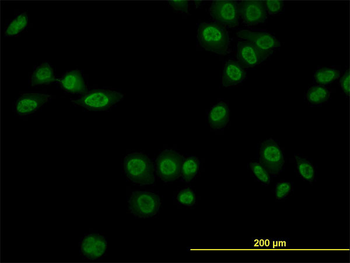 NR1D1 monoclonal antibody (M02), clone 4F6