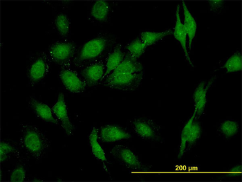SEC22L1 monoclonal antibody (M01), clone 1E1