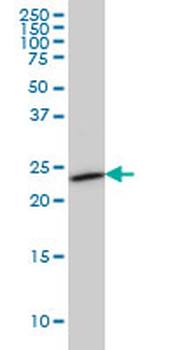 SEC22L1 monoclonal antibody (M01), clone 1E1