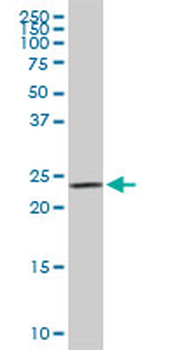 SEC22L1 monoclonal antibody (M01), clone 1E1