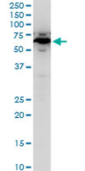SPTLC2 polyclonal antibody (A01)