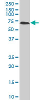 SPTLC2 polyclonal antibody (A01)