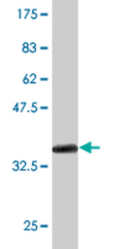 SLC4A8 monoclonal antibody (M05), clone 1G10