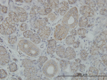 SLC4A8 monoclonal antibody (M04), clone 6E11
