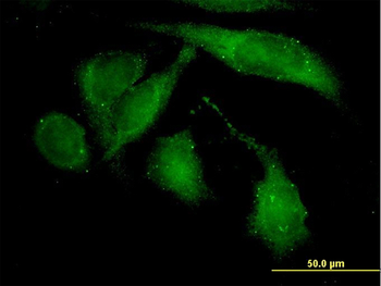 ROCK2 monoclonal antibody (M02), clone 1E12