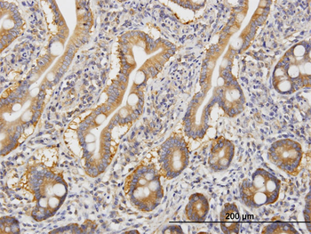 ROCK2 monoclonal antibody (M02), clone 1E12