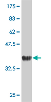 ROCK2 monoclonal antibody (M02), clone 1E12