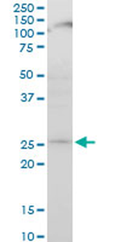 ATG5 monoclonal antibody (M04), clone 1G11