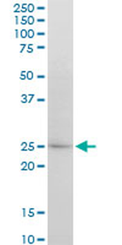 ATG5 monoclonal antibody (M04), clone 1G11