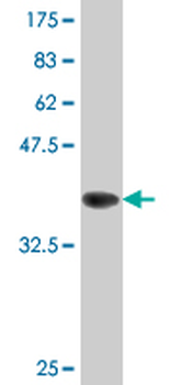 ATG5 monoclonal antibody (M04), clone 1G11