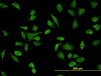 SH3BP5 monoclonal antibody (M01), clone 2B3