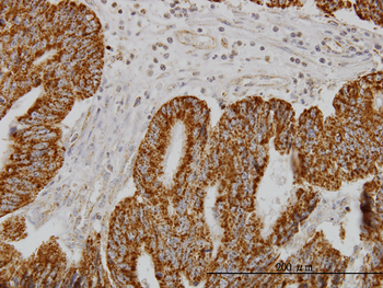 SH3BP5 monoclonal antibody (M01), clone 2B3