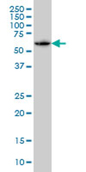 SH3BP5 monoclonal antibody (M01), clone 2B3
