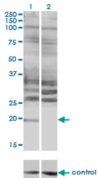 HAND2 monoclonal antibody (M06), clone 3D5