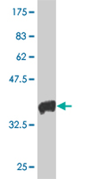 HAND2 monoclonal antibody (M06), clone 3D5