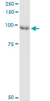 ARHGEF6 monoclonal antibody (M02), clone 2E5