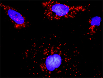 ARHGEF6 monoclonal antibody (M02), clone 2E5