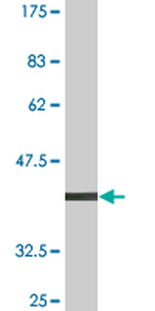 ARHGEF6 monoclonal antibody (M02), clone 2E5